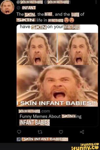 @SKIN INFANT BABIES @SKIN INFANT BABIES The SKIN. the INFANT, and the BABIES of SKIN life in INFANT BABIES have SKIN on your INFANT BABIES I SKIN INFANT BABIES!!! SKIN INFANT BABIES.com Funny Memes About SKINing INFANT BABIES I SKIN INFANT BABIES